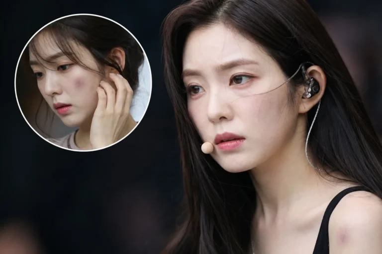 Red Velvet Irene fan concern ahead of comeback and concert rehearsals
