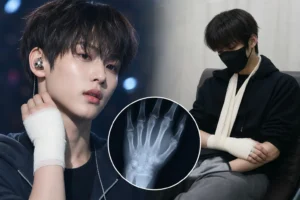 CORTIS Keonho tour performance adjustment after hand fractures