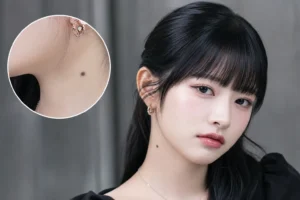 IVE Rei Starship mole removal discussion K-pop idol image control